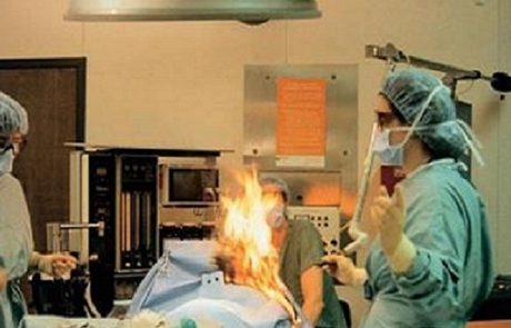 אישה מפליצה במהלך ניתוח ועולה באש – אז הדברים הופכים מפחידים באמת